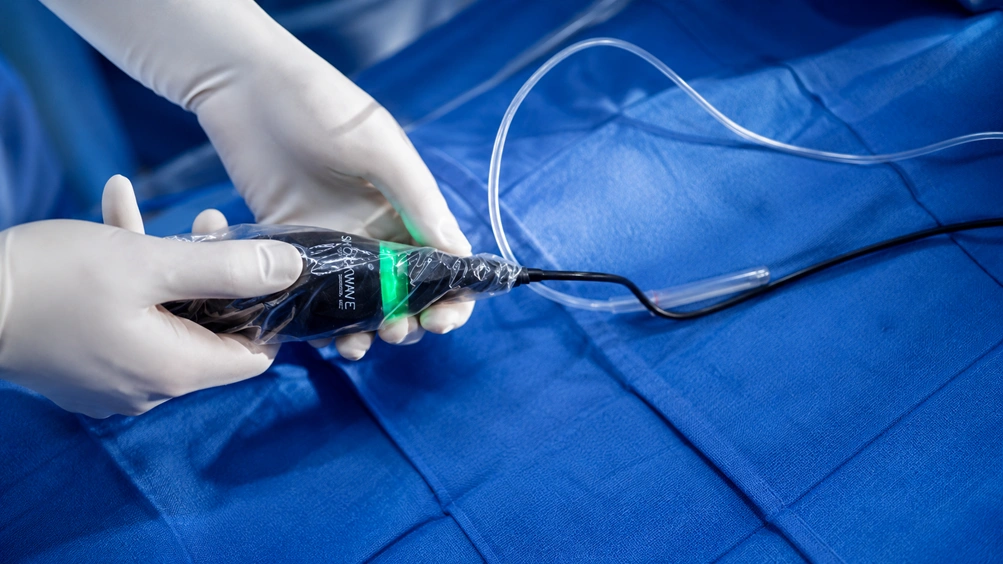 Johnson & Johnson Advances the Standard of Calcium Modification with Global Launch of Shockwave™ C2 Aero Coronary IVL Catheter