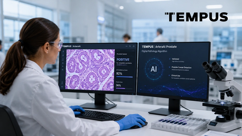 Tempus Launches ArteraAI Prostate Test for Metastatic Patients