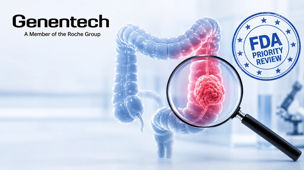 FDA Grants Priority Review for Genentech’s Tecentriq for a Certain Type of Stage III Colon Cancer