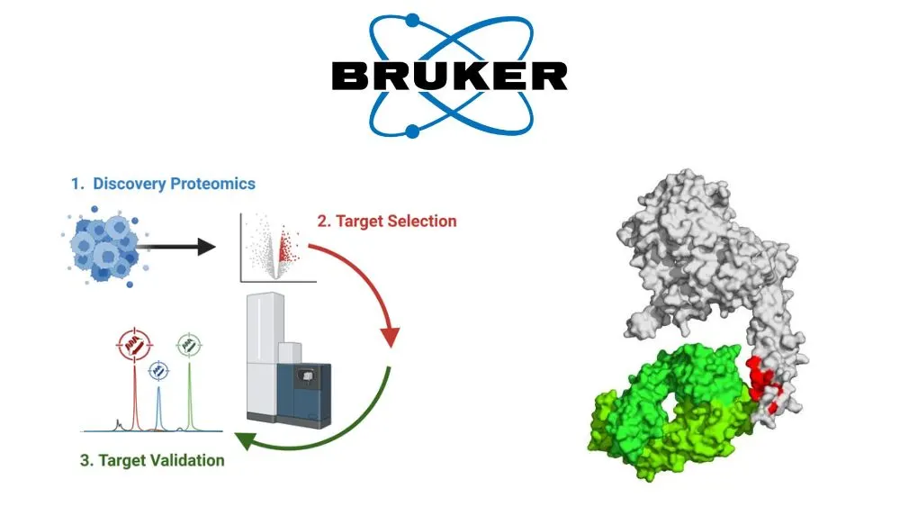 Bruker